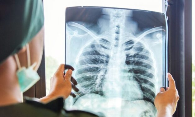 Suatu Teknologi Rontgen Dalam Dunia Kesehatan, Yuk Simak